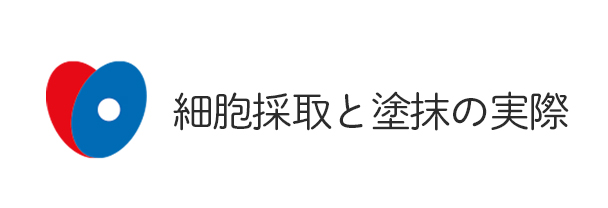 細胞採取と塗抹の実際